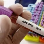 Tes HPV DNA Gratis