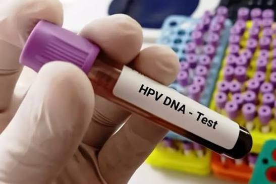 Tes HPV DNA Gratis